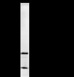 STAT3 Antibody (clone STAAD22A)