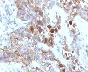 NCAM / CD56 Antibody (clone NCAM1/795)