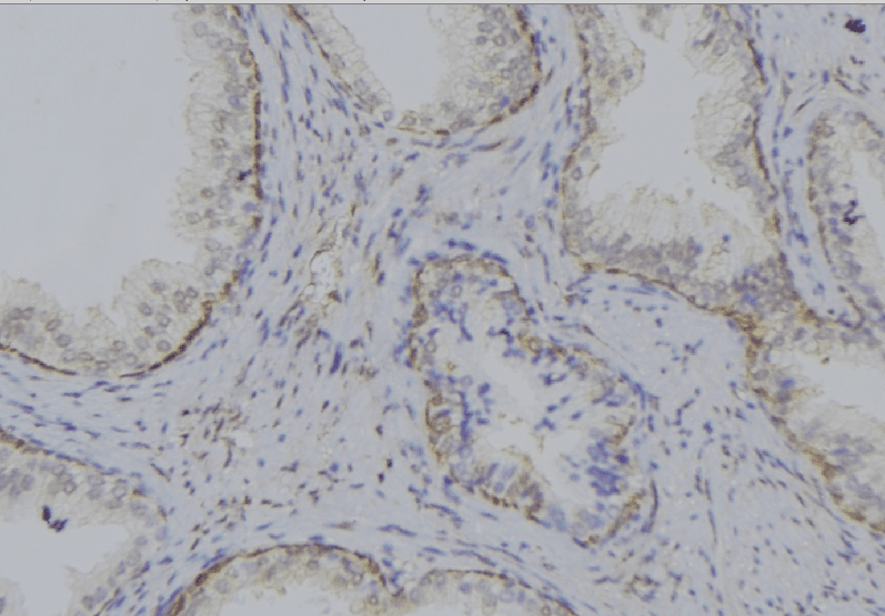 p66 / SHC Antibody
