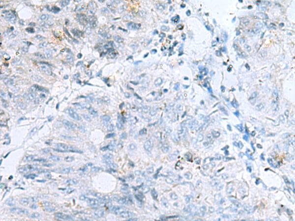 POMC / Proopiomelanocortin Antibody