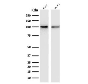 Monoclonal Mouse anti-Human ENAH / MENA Antibody (clone ENAH/1988, WB)