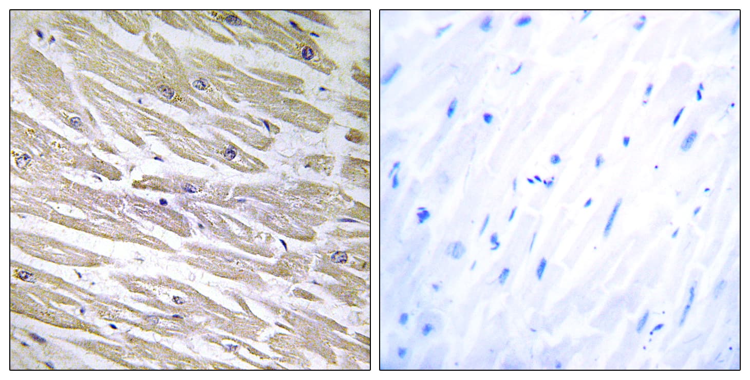 LAMA4 / Laminin Alpha 4 Antibody (aa481-530)