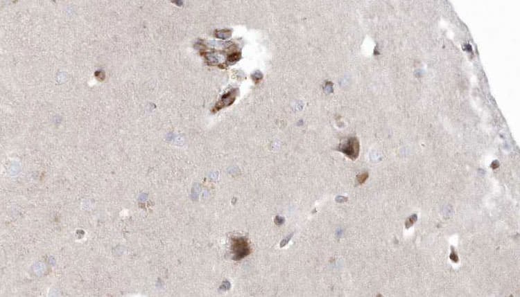 OXCT1 Antibody