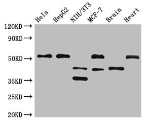 Polyclonal Rabbit anti-Human LAX1 / LAX Antibody (IF, WB)