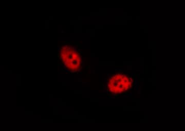 PTPN6 / SHP1 Antibody (phospho-Tyr536)