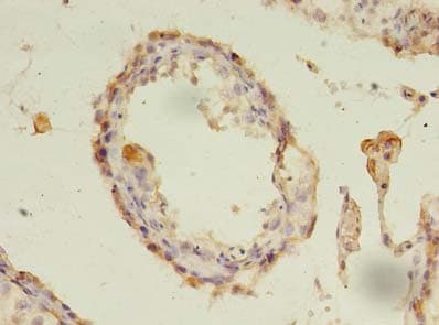 CXADR Antibody
