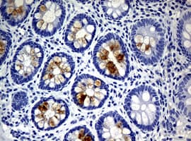 WFDC2 / HE4 Antibody (aa31-124, clone OTI2A7, Carrier-free)