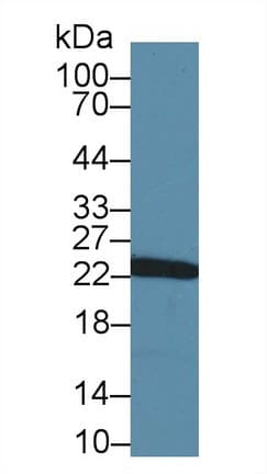 GSTP1 / GST Pi Antibody (aa1-210, PE)
