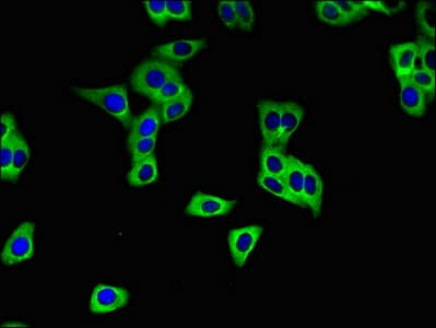 SLC28A3 Antibody