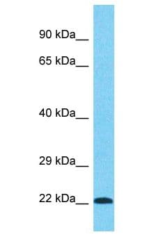 PRPF38B Antibody (aa74-123)