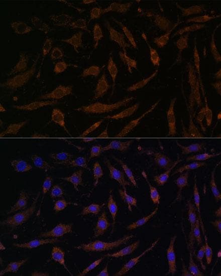 RPS6KA1 / RSK1 Antibody
