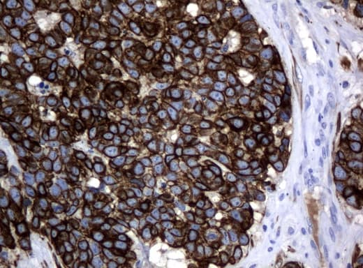 Monoclonal Mouse anti-Human KRT18 / CK18 / Cytokeratin 18 Antibody (clone UMAB50, Carrier-free, aa69-372, IHC, IF, WB)