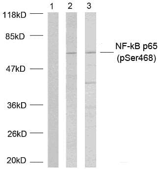 Polyclonal Rabbit anti-Human RELA / NFKB p65 Antibody (phospho-Ser468, IHC, WB)