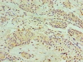 HNRPM / HNRNPM Antibody (aa491-730)
