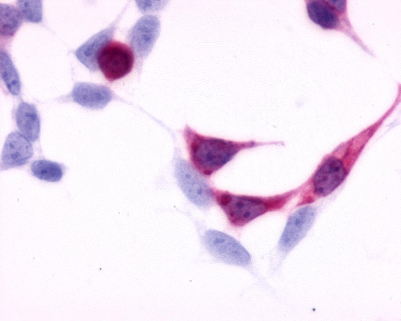 PathPlus™ EDNRB / Endothelin B Receptor Antibody (N-Terminus)