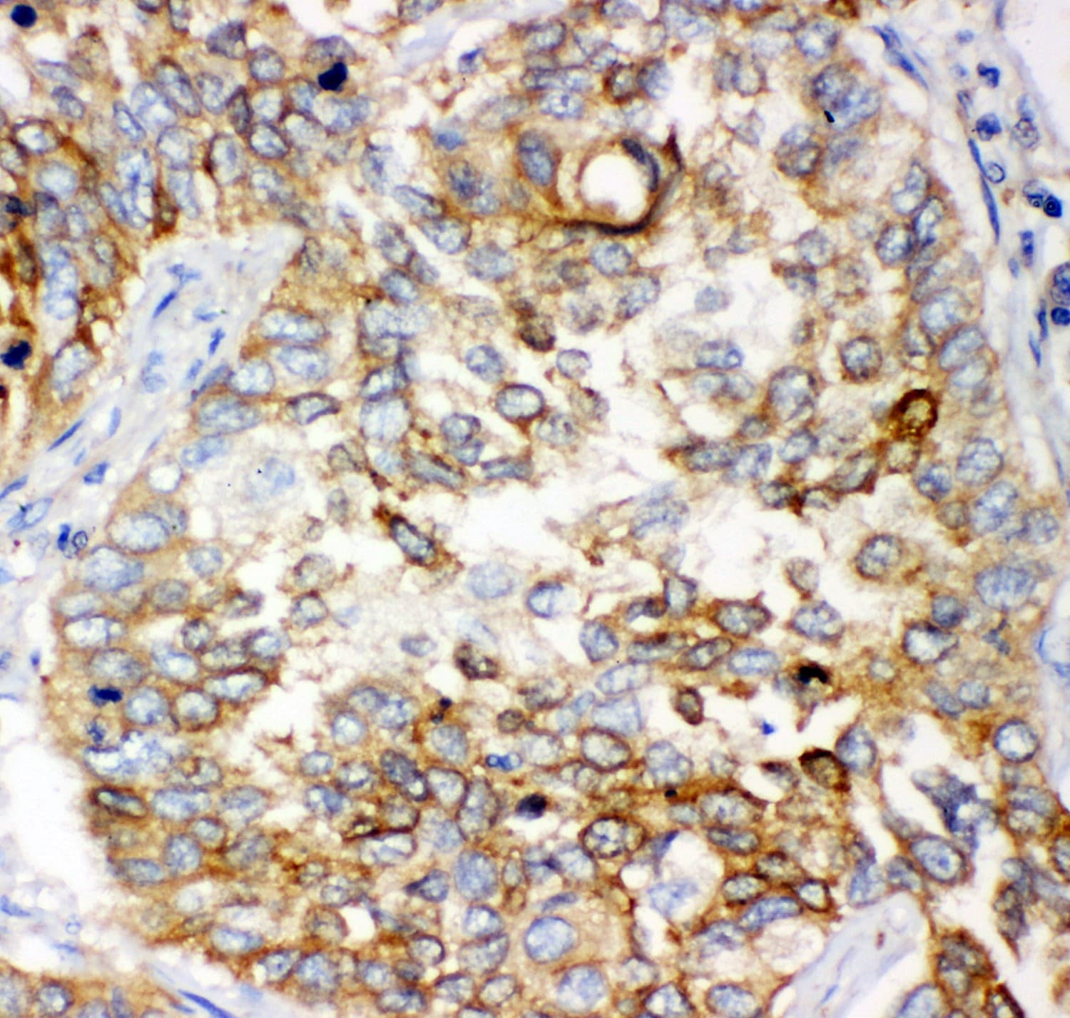 GCLC Antibody (aa437-637)