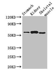 PPM1H Antibody