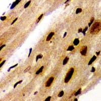 PSME1 Antibody