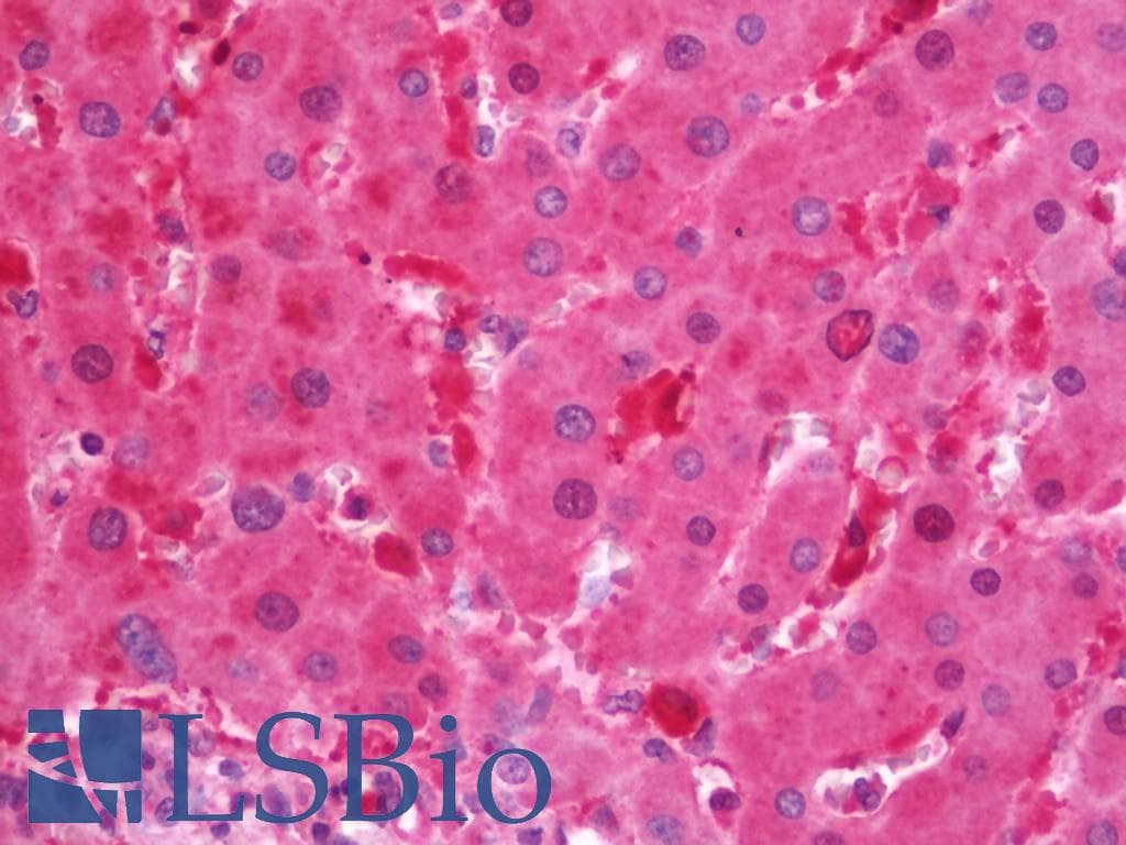 FTL / Ferritin Light Chain Antibody (HRP)