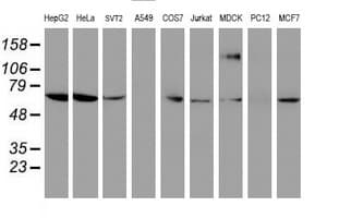 FOLH1 / PSMA Antibody (clone OTI2E1)