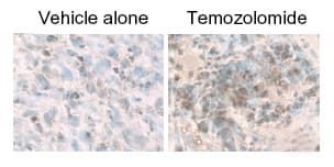 IHC-plus™ MAP1LC3B / LC3B Antibody (N-Terminus)