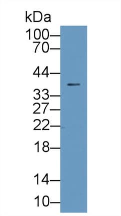 LGALS1 / Galectin 1 Antibody (aa2-135, APC)