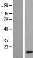 Human FAM195B Protein (Over-Expression Lysate Myc-DDK (Flag))