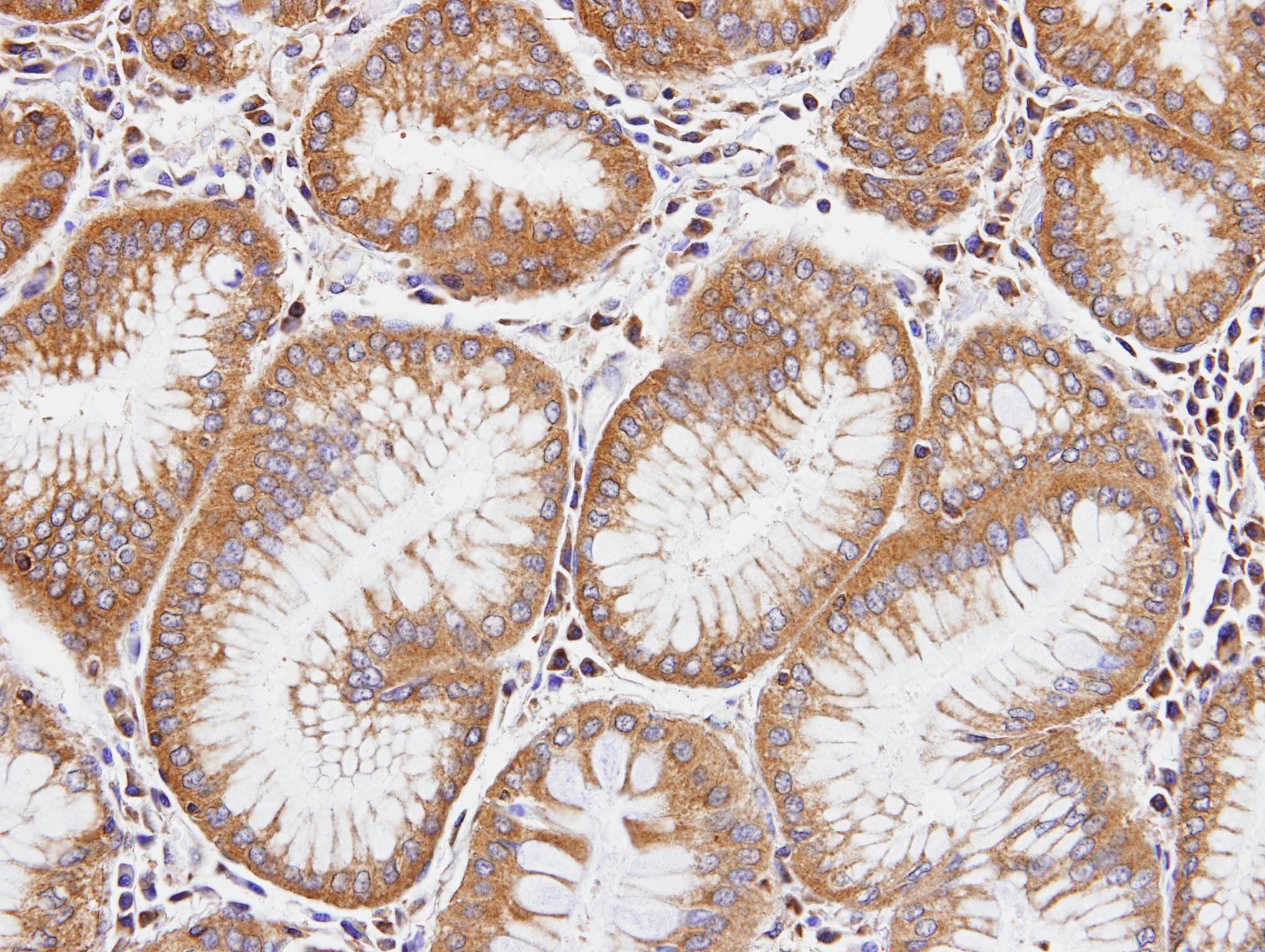 DIAPH1 Antibody (aa1-237)