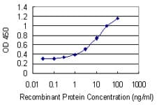 Monoclonal Mouse anti-Human PARK2 / Parkin 2 Antibody (clone 1H4, IF, WB)