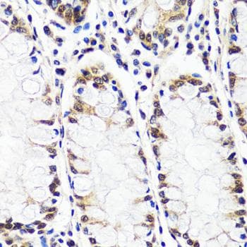 TIP120 / CAND1 Antibody