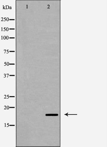 CASP6 / Caspase 6 Antibody (Cleaved Asp179)