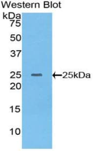 IL-10 Antibody (aa19-178)