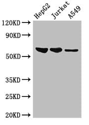 Polyclonal Rabbit anti-Human UAP1 Antibody (IHC, IF, WB)