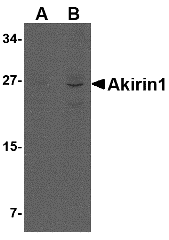 Polyclonal Rabbit anti-Human AKIRIN1 Antibody (WB)