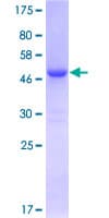 Human CBX1 / HP1 Beta Protein (Recombinant GST)