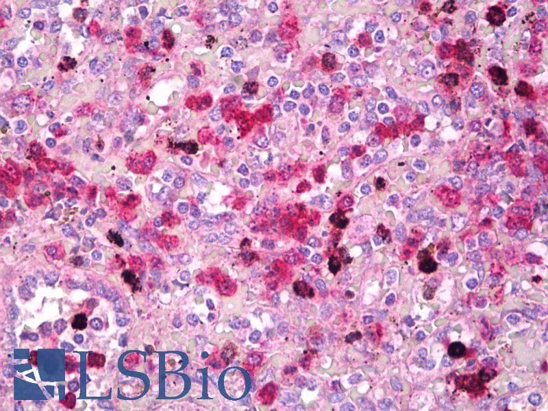 IHC-plus™ TFEB Antibody