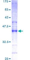 Human Fragilis / IFITM3 Protein (Recombinant GST)