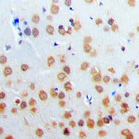PARP3 Antibody (N-Terminus)