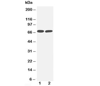TNFRSF1B / TNFR2 Antibody (aa103-121)