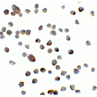 IHC-plus™ Polyclonal Rabbit anti-Human REEP3 Antibody (IHC, IF, WB)