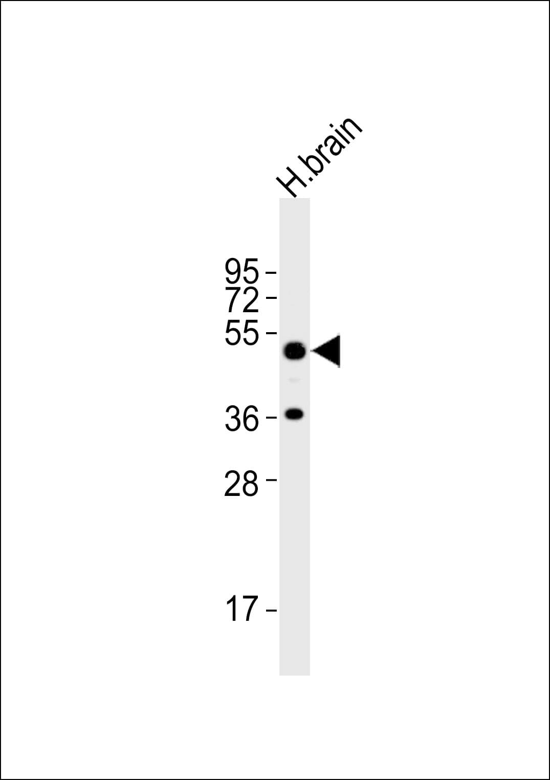 Polyclonal Rabbit anti-Human THRA / THR Alpha Antibody (WB)