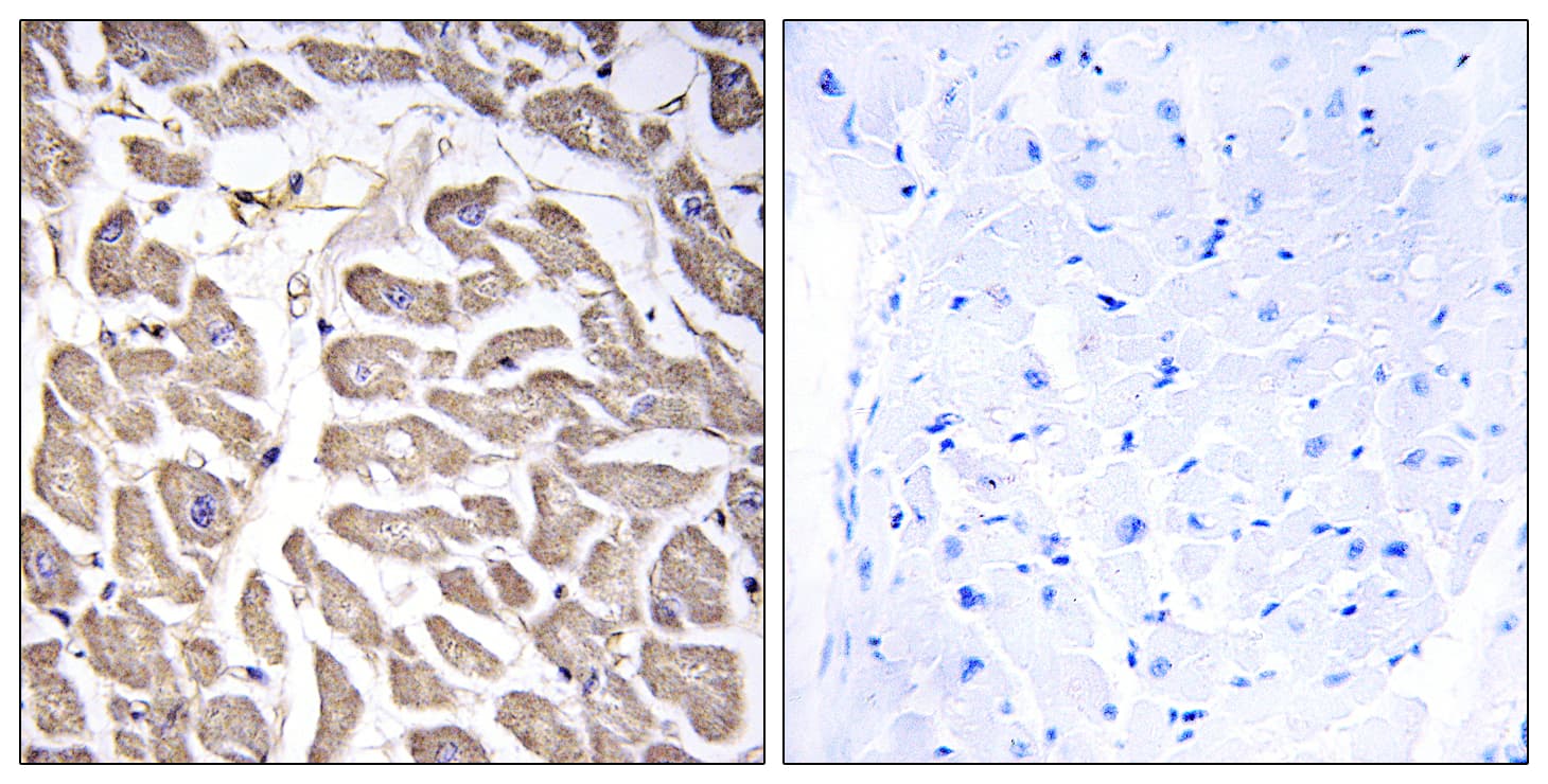 BRWD3 Antibody (aa1751-1800)