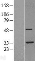 PSMC5 / SUG1 Protein (Over-Expression Lysate Myc-DDK (Flag))