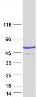 Human PRKAR1A Protein (Recombinant Myc-DDK (Flag))