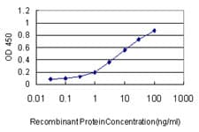 KIF2C / MCAK Antibody (clone 1G2)