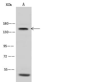 Polyclonal Rabbit anti-Mouse NEFM / NF-M Antibody (Preservative Free, IHC, WB)