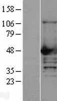 NCF1 / p47phox / p47 phox Protein (Over-Expression Lysate Myc-DDK (Flag))
