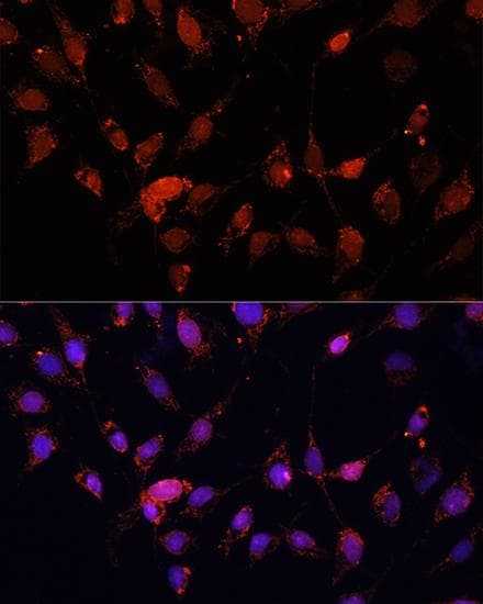 EIF4EBP1 / 4EBP1 Antibody