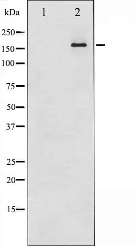 Polyclonal Rabbit anti-Human MED1 / TRAP220 Antibody (IF, WB)