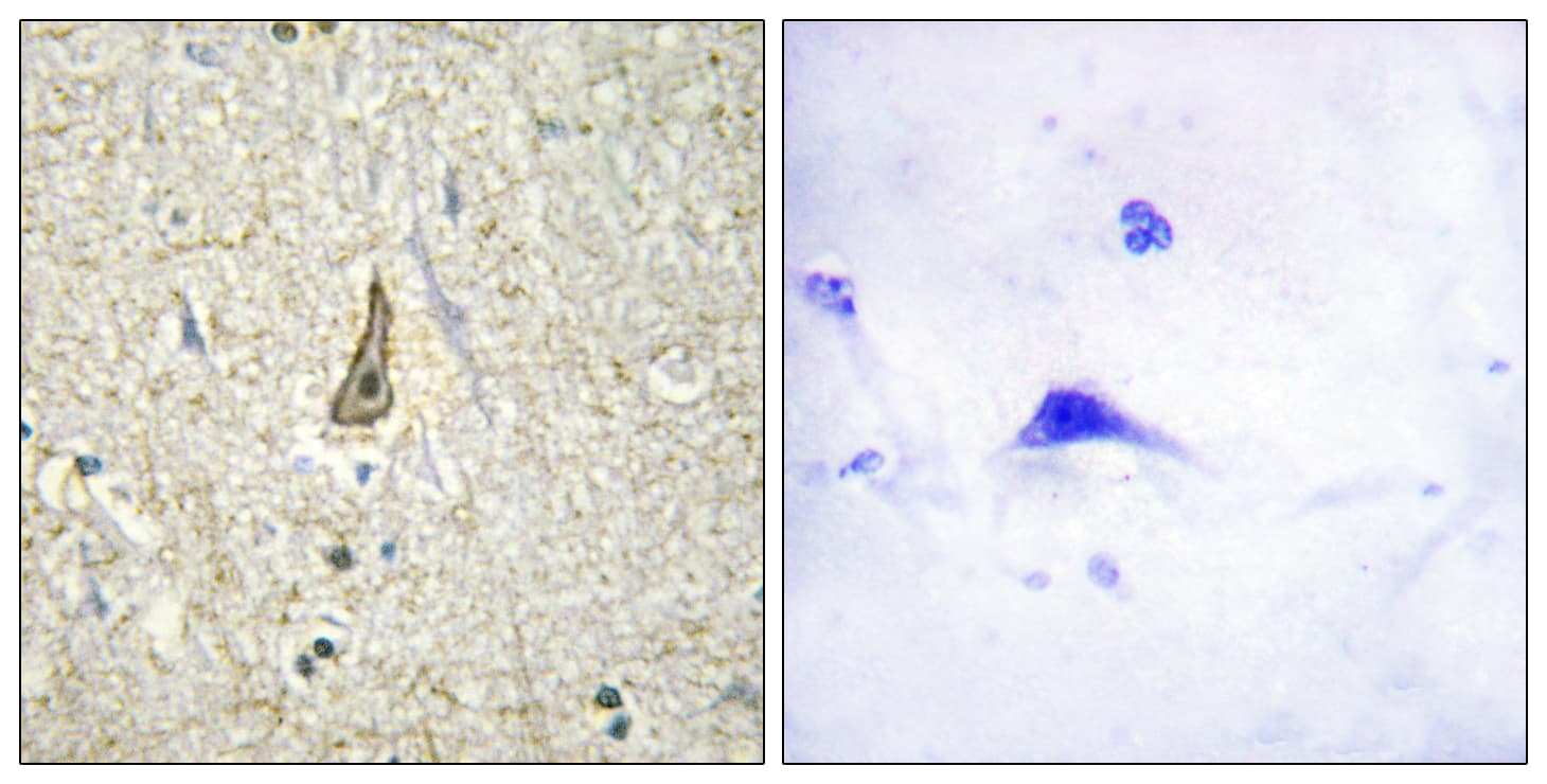 CYP26C1 Antibody (aa41-90)